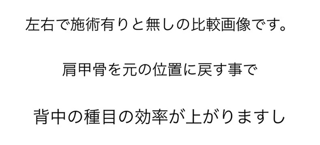 左右で施術有りと無しの比較画像です。肩甲骨を元の位置に戻す事で背中の種目の効率が上がりますし