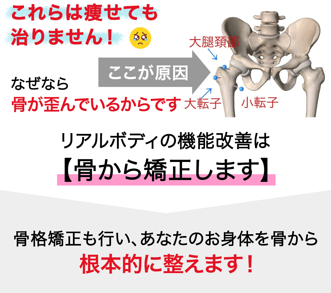 これらは痩せても治りません、なぜなら骨が歪んでいるからです。リアルボディの機能改善は骨から矯正します。骨格矯正も行い、あなたのお身体を骨から根本的に整えます！