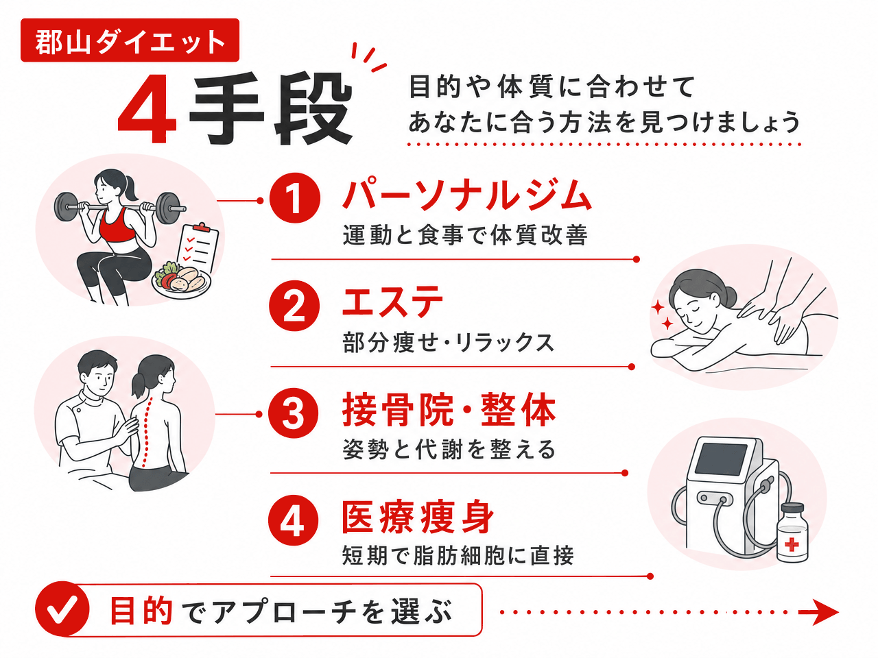 郡山ダイエットの4手段比較図解（①パーソナルジム=運動と食事で体質改善／②エステ=部分痩せ・リラックス／③接骨院・整体=姿勢と代謝を整える／④医療痩身=短期で脂肪細胞に直接アプローチ／目的でアプローチを選ぶ）